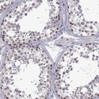 Immunohistochemical staining of human testis shows high expression.