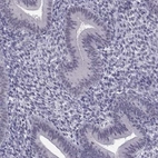 Immunohistochemical staining of human endometrium shows low expression as expected.