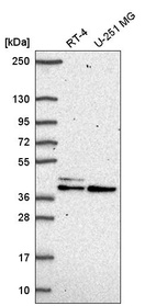 Anti-SETMAR Antibody