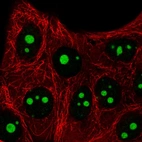 Immunofluorescent staining of human cell line MCF7 shows localization to nucleoli.