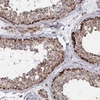 Immunohistochemical staining of human testis shows strong granular cytoplasmic positivity in cells in seminiferous ducts.
