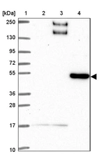 Lane 1: Marker [kDa] 250, 130, 95, 72, 55, 36, 28, 17, 10_br/_Lane 2: Human cell line RT-4_br/_Lane 3: Human cell line U-251MG sp_br/_Lane 4: Human plasma (IgG/HSA depleted)