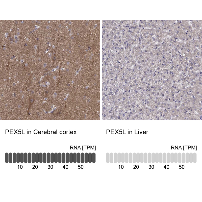 Anti-PEX5L Antibody