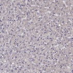 Immunohistochemical staining of human liver shows low expression as expected.