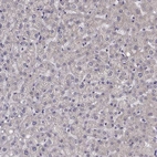 Immunohistochemical staining of human liver shows low expression as expected.