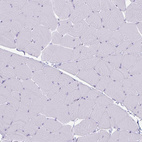 Immunohistochemical staining of human skeletal muscle no positivity in myocytes as expected.