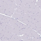 Immunohistochemical staining of human skeletal muscle no positivity in myocytes as expected.