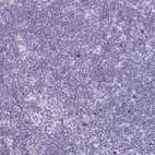 Immunohistochemical staining of human lymph node shows strong cytoplasmic positivity in a small subset of non-germinal center cells.