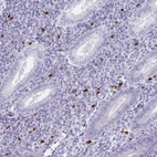 Immunohistochemical staining of human endometrium strong cytoplasmic positivity in lymphoid cells.