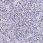 Immunohistochemical staining of human spleen shows strong cytoplasmic positivity in cells in red pulp.