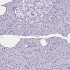 Immunohistochemical staining of human pancreas shows no positivity in exocrine glandular cells as expected.