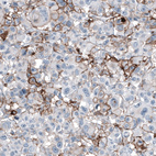 Anti-CD44 Antibody