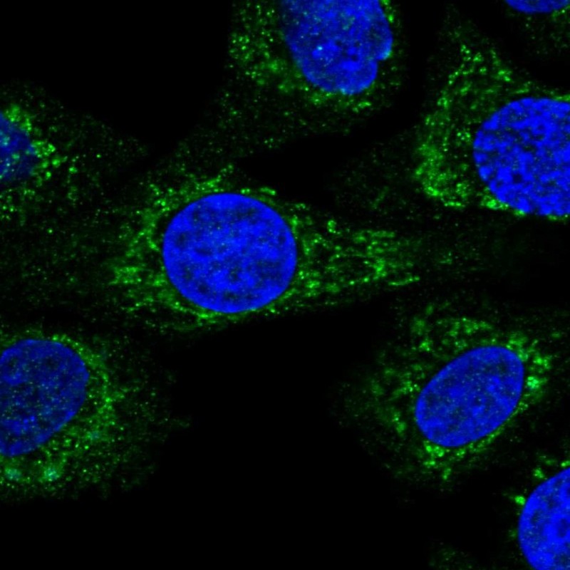 Anti-KCTD18 Antibody