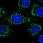 Anti-KCTD18 Antibody