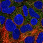 Immunofluorescent staining of human cell line HEK 293 shows localization to cytosol.