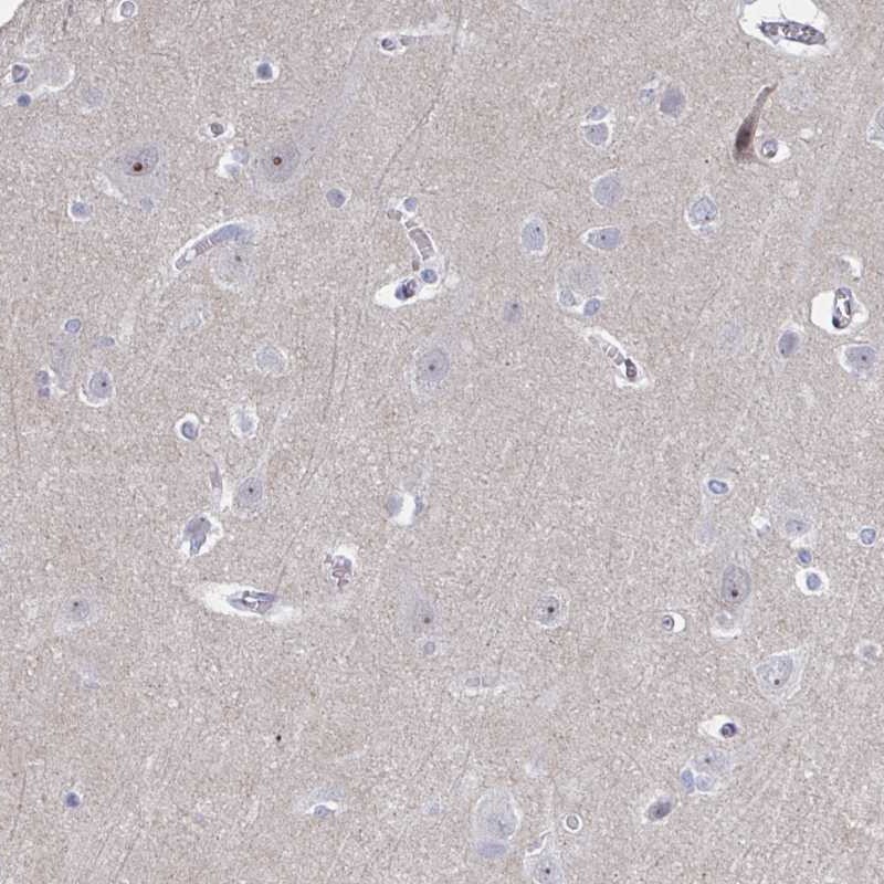 Anti-CENPT Antibody