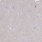 Anti-CENPT Antibody