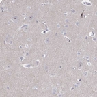 Anti-CENPT Antibody