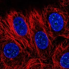 Immunofluorescent staining of human cell line MCF7 shows localization to nuclear bodies.