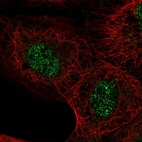 Anti-ASXL2 Antibody