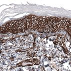 Immunohistochemical staining of human skin shows strong membranous positivity in squamous epithelial cells.