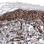 Immunohistochemical staining of human skin shows strong membranous positivity in squamous epithelial cells.