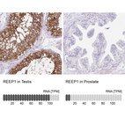 Anti-REEP1 Antibody