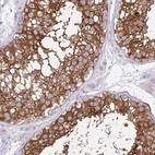 Immunohistochemical staining of human testis shows high expression.