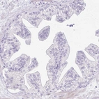 Immunohistochemical staining of human prostate shows low expression as expected.
