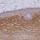 Anti-OR10Z1 Antibody