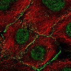 Anti-AGO2 Antibody