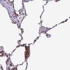 Anti-SELENON Antibody