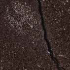 Immunohistochemical staining of human tonsil shows strong membranous positivity in non-germinal center cells.
