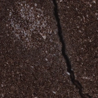 Immunohistochemical staining of human tonsil shows strong membranous positivity in non-germinal center cells.