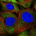 Immunofluorescent staining of human cell line A-431 shows localization to cytosol.