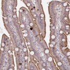 Anti-PRSS33 Antibody