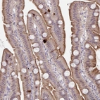 Anti-PRSS33 Antibody