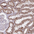 Anti-SARDH Antibody