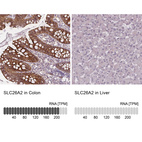 Anti-SLC26A2 Antibody