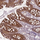 Immunohistochemical staining of human colon shows strong membranous positivity in glandular cells.