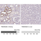 Anti-TMEM52B Antibody