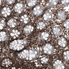 Immunohistochemical staining of human colon shows strong membranous positivity in lymphoid cells.