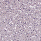 Anti-SLC26A2 Antibody