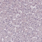 Immunohistochemical staining of human liver shows no positivity in hepatocytes as expected.