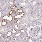 Anti-TMEM52B Antibody