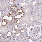 Immunohistochemical staining of human kidney shows strong membranous positivity in cells in distal tubules.
