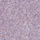 Anti-SLC26A2 Antibody