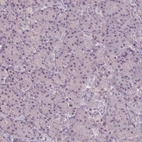 Immunohistochemical staining of human pancreas shows no positivity in exocrine glandular cells as expected.