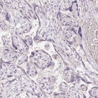 Immunohistochemical staining of human placenta shows no positivity in trophoblastic cells as expected.