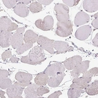 Immunohistochemical staining of human skeletal muscle shows no positivity in myocytes as expected.